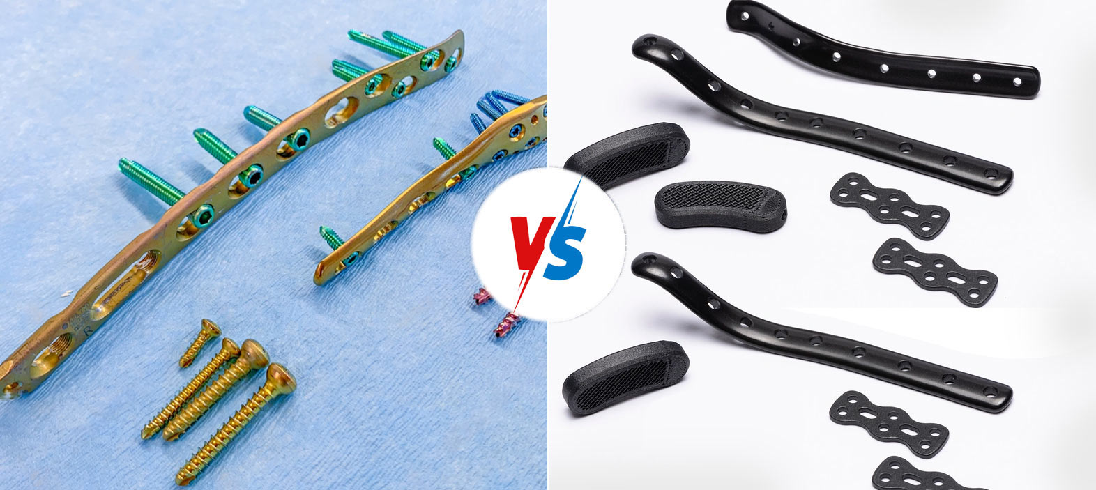 Carbon fiber implants vs Titanium implants