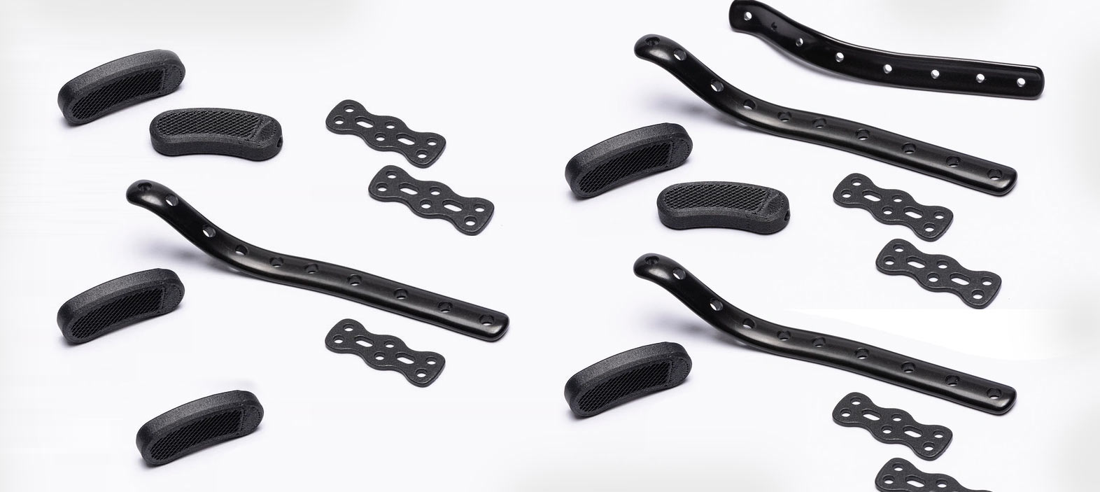 Long-Term Local Effects of Carbon Fiber in Orthopaedic Surgery