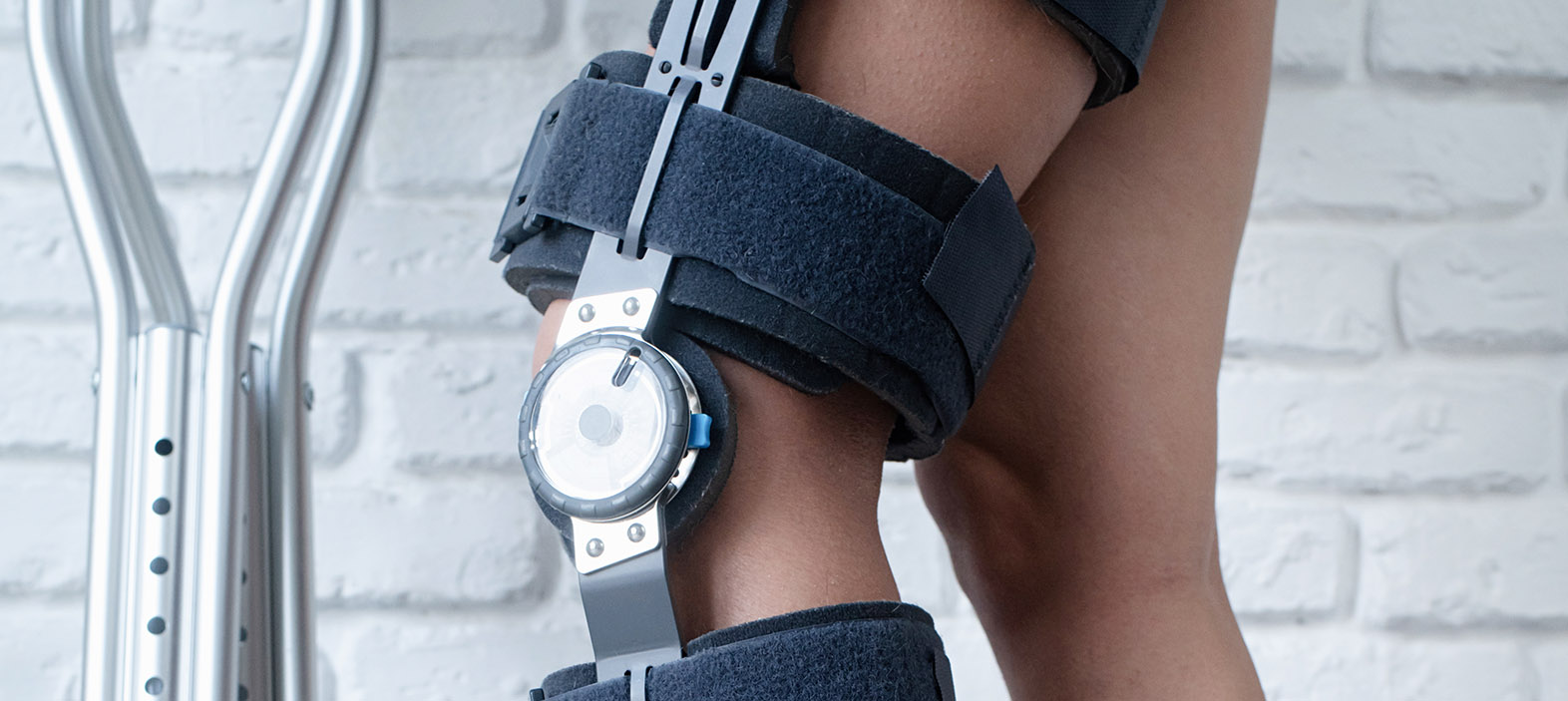 Use of Carbon-Fiber Implants in Orthopedic Surgery